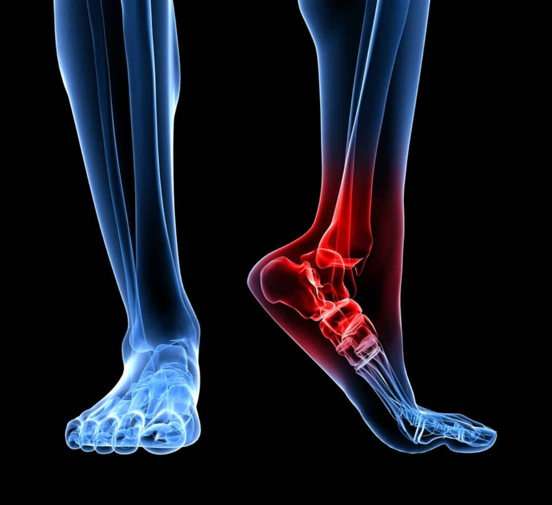 Sandales orthopédiques pour femmes | Confort